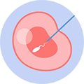 卵泡浆内单精子显微注射